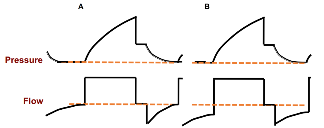 無(wú)創(chuàng)呼吸機(jī)