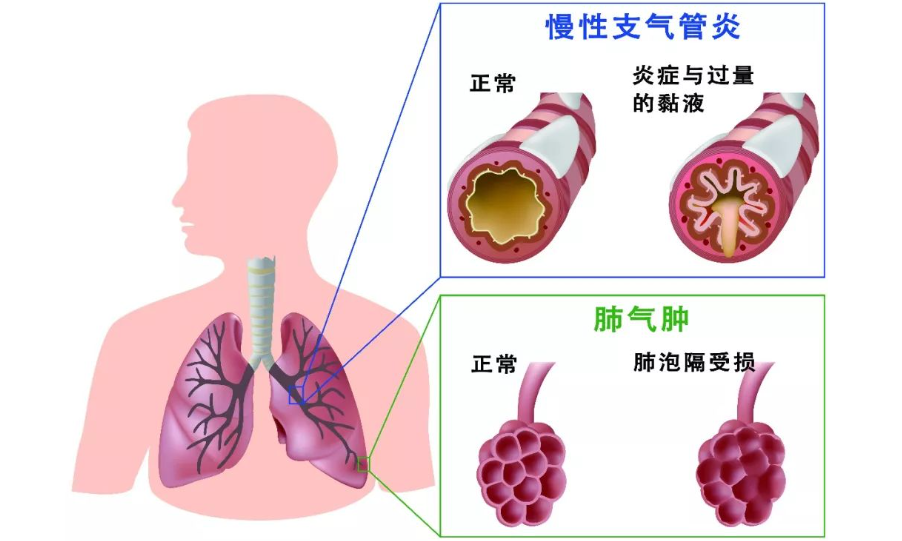 高流量呼吸濕化治療儀