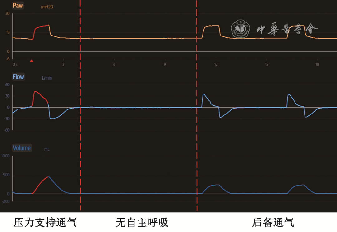 無(wú)創(chuàng)呼吸機(jī)