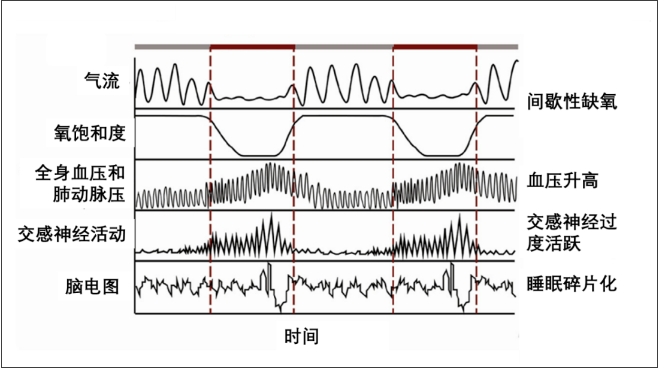 無創(chuàng)呼吸機