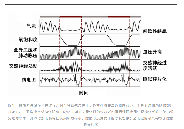 無(wú)創(chuàng)呼吸機(jī),高流量呼吸濕化治療儀,睡眠監(jiān)測(cè)