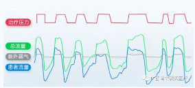 無(wú)創(chuàng)呼吸機(jī),高流量呼吸濕化治療儀,睡眠監(jiān)測(cè)