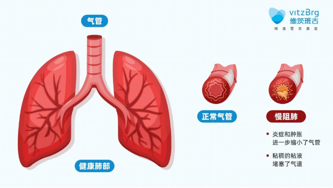 無創(chuàng)呼吸機(jī),高流量呼吸濕化治療儀,睡眠監(jiān)測